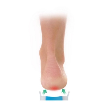 ΥΠΟΠΤΕΡΝΙΟ ΣΙΛΙΚΟΝΗΣ-ΑΚΑΝΘΑ